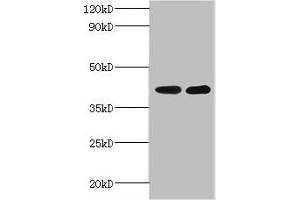 Western blot All lanes: GLT8D2 antibody at 2 μg/mL Lane 1: Mouse heart tissue Lane 2: Mouse kidney tissue Secondary Goat polyclonal to rabbit IgG at 1/10000 dilution Predicted band size: 41 kDa Observed band size: 41 kDa (GLT8D2 anticorps  (AA 25-349))