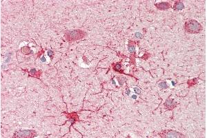 anti-Carnitine O-Octanoyltransferase (CROT) (AA 178-199) antibody