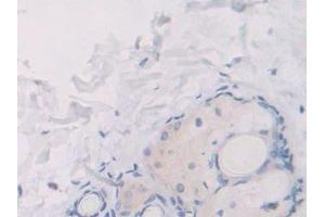 Detection of UCP1 in Rat Skin Tissue using Polyclonal Antibody to Uncoupling Protein 1, Mitochondrial (UCP1)