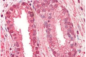 anti-Cathepsin L1 (CTSL1) (AA 114-333) antibody