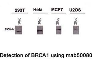 Image no. 4 for anti-Breast Cancer 1 (BRCA1) (AA 1314-1600), (AA 1314-1864) antibody (ABIN363234) (BRCA1 anticorps  (AA 1314-1600, AA 1314-1864))