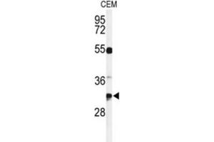 Western Blotting (WB) image for anti-Tetraspanin 7 (TSPAN7) antibody (ABIN5021792) (Tetraspanin 7 anticorps)