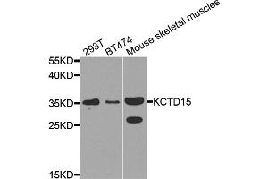 Western blot analysis of extracts of various cell lines, using KCTD15 antibody. (KCTD15 anticorps)