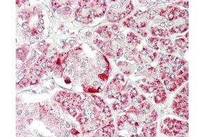 Human Pancreas: Formalin-Fixed, Paraffin-Embedded (FFPE)