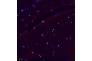 Immunofluorescence of paraffin embedded rat skeletal muscle using BCMA (ABIN7076067) at dilution of 1: 600 (400x lens)