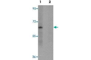 Western blot analysis of mouse lung tissue with ZSCAN4 polyclonal antibody  in (Lane 1) the absence and (Lane 2) presence of peptide blocking. (ZSCAN4 anticorps  (C-Term))