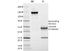 SDS-PAGE Analysis Purified HLA-DR Mouse Monoclonal Antibody (DA2). (HLA-DRB1 anticorps)