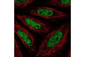 Immunofluorescent staining of SiHa cells with NR4A2 polyclonal antibody  (Green) shows positivity in nucleus but excluded from the nucleoli.