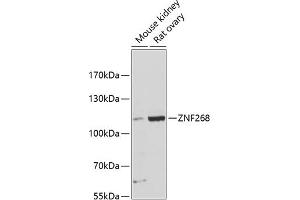 Western blot analysis of extracts of various cell lines, using ZNF268 antibody (ABIN6133062, ABIN6150485, ABIN6150486 and ABIN6216704) at 1:3000 dilution. (ZNF268 anticorps  (AA 1-270))