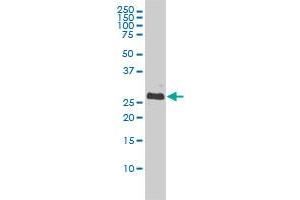 BCL2L1 monoclonal antibody (M01), clone 3E2-2A5 Western Blot analysis of BCL2L1 expression in A-431 .
