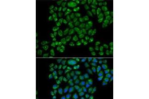 Immunofluorescence analysis of HeLa cells using GRIA3 Polyclonal Antibody (Glutamate Receptor 3 anticorps)