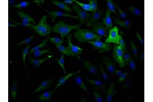 Immunofluorescence staining of Hela Cells with ABIN7127459 at 1:50, counter-stained with DAPI. (Recombinant DNM2 anticorps)