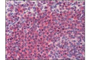 Immunohistochemistry (IHC) image for anti-BRCA1/BRCA2-Containing Complex, Subunit 3 (BRCC3) (AA 1-316), (N-Term) antibody (ABIN400864)