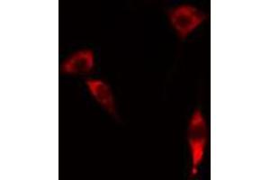 ABIN6274329 staining RAW264. (FOXC1 anticorps)