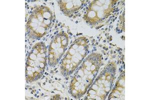 Immunohistochemistry of paraffin-embedded human colon using MYD88 Antibody (ABIN6290608) at dilution of 1:100 (40x lens).