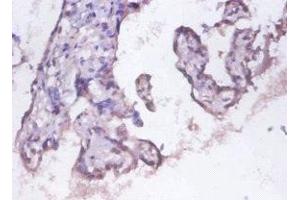 Immunohistochemistry of paraffin-embedded human placenta tissue using ABIN7142202 at dilution of 1:100 (PSMD11 anticorps  (Regulatory Subunit 11))