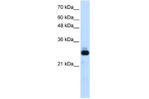 WB Suggested Anti-SAP30 Antibody Titration:  1. (SAP30 anticorps  (Middle Region))