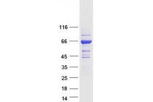 Validation with Western Blot
