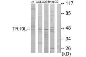 Western blot analysis of extracts from Jurkat cells, COLO205 cells, 293 cells and HepG2 cells, using TR19L antibody. (RELT anticorps  (C-Term))