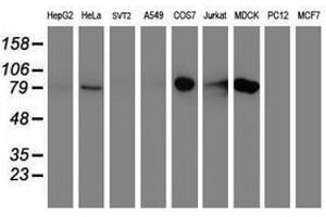 Image no. 2 for anti-Diacylglycerol Kinase, alpha 80kDa (DGKA) antibody (ABIN1497818) (DGKA anticorps)