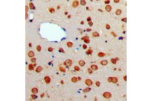 Immunohistochemical analysis of CD256 staining in human brain formalin fixed paraffin embedded tissue section.