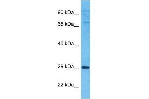 Host:  Rabbit  Target Name:  EXOS5  Sample Type:  721_B Whole Cell lysates  Antibody Dilution:  1. (EXOSC5 anticorps  (N-Term))