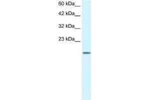 WB Suggested Anti-ZNF7 Antibody Titration:  1. (ZNF7 anticorps  (N-Term))