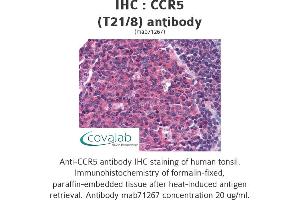 Image no. 1 for anti-Chemokine (C-C Motif) Receptor 5 (CCR5) antibody (ABIN1724086) (CCR5 anticorps)
