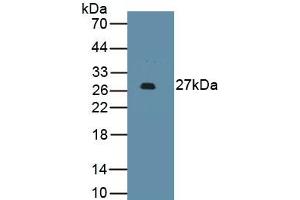 Detection of Recombinant PDCD1LG2, Human using Monoclonal Antibody to Programmed Cell Death Protein 1 Ligand 2 (PDL2) (PDCD1LG2 anticorps  (AA 33-236))