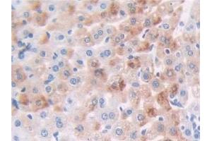 Detection of CDK1 in Mouse Liver Tissue using Polyclonal Antibody to Cyclin Dependent Kinase 1 (CDK1)