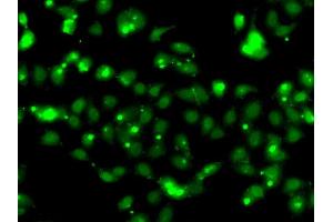 Immunofluorescence analysis of HeLa cell using CLK1 antibody. (CLK1 anticorps)