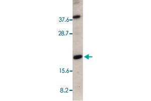 Western blot analysis of 50 ug of total cell lysate from HeLa cells with CRADD polyclonal antibody  at 1 : 500 dilution. (CRADD anticorps  (AA 181-199))