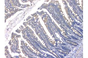 anti-Histone Deacetylase 5 (HDAC5) (AA 102-197) antibody