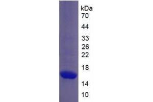 SDS-PAGE analysis of Monkey Collagen Type X Protein. (COL10 Protéine)