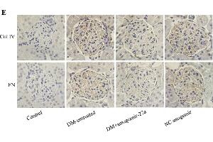 Inhibition of miR-27a with antagomir-27a reduces the expression of profibrotic genes and ECM proteins in the kidney glomeruli of STZ-induced diabetic rats.