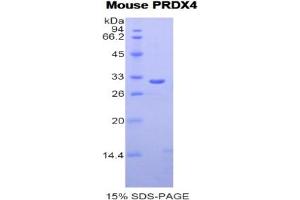 SDS-PAGE analysis of Mouse Peroxiredoxin 4 Protein.