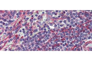 Rabbit Anti-MCTP1 Antibody  arp44441 Paraffin Embedded Tissue: Human Spleen Antibody Concentration: 5 ug/ml (MCTP1 anticorps  (Middle Region))