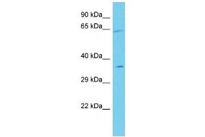 Host: Rabbit Target Name: ANKRD55 Sample Type: Jurkat Whole Cell lysates Antibody Dilution: 1. (ANKRD55 anticorps  (C-Term))
