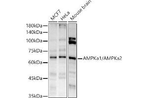Western blot analysis of extracts of various cell lines, using AMPKa1/AMPKa2 antibody (ABIN6129902, ABIN6136848, ABIN6136849 and ABIN7101410) at 1:1000 dilution. (AMPK alpha anticorps)