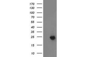 Western Blotting (WB) image for anti-Methylmalonic Aciduria (Cobalamin Deficiency) CblB Type (MMAB) antibody (ABIN1499509) (MMAB anticorps)