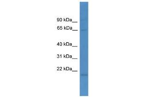 WB Suggested Anti-LTA4H Antibody Titration: 0. (LTA4H anticorps  (N-Term))