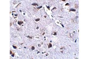 Immunohistochemical staining of mouse brain tissue with 2. (RCAN2 anticorps  (Internal Region))