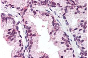 Human Prostate (formalin-fixed, paraffin-embedded) stained with DDX3X antibody ABIN337076 at 5 ug/ml followed by biotinylated goat anti-rabbit IgG secondary antibody ABIN481713, alkaline phosphatase-streptavidin and chromogen. (DDX3X anticorps  (N-Term))