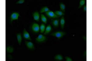 Immunofluorescence staining of A549 cells with ABIN7144872 at 1:166, counter-stained with DAPI. (ABCA12 anticorps  (AA 45-158))