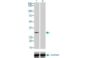 Western blot analysis of TLX3 over-expressed 293 cell line, cotransfected with TLX3 Validated Chimera RNAi (Lane 2) or non-transfected control (Lane 1). (TLX3 anticorps  (AA 192-291))