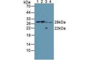 Figure. (Calpain S1 anticorps  (AA 1-268))