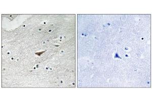 Immunohistochemistry analysis of paraffin-embedded human brain tissue using VE-Cadherin (Phospho-Tyr731) antibody. (Cadherin 5 anticorps  (pTyr731))