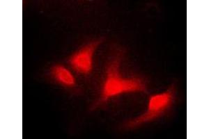 Immunofluorescent analysis of ABL1 staining in K562 cells. (ABL1 anticorps  (C-Term))