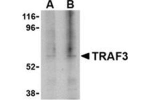 Western blot analysis of TRAF3 in 3T3 cell lysate with this product at (A) 1, and (B) 2 μg/ml. (TRAF3 anticorps  (C-Term))