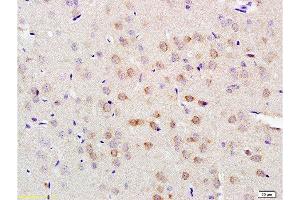 Formalin-fixed and paraffin embedded rat brain tissue labeled with Anti-LLGL1/2 Polyclonal Antibody, Unconjugated  at 1:200 followed by conjugation to the secondary antibody and DAB staining (LLGL1 anticorps  (AA 801-900))